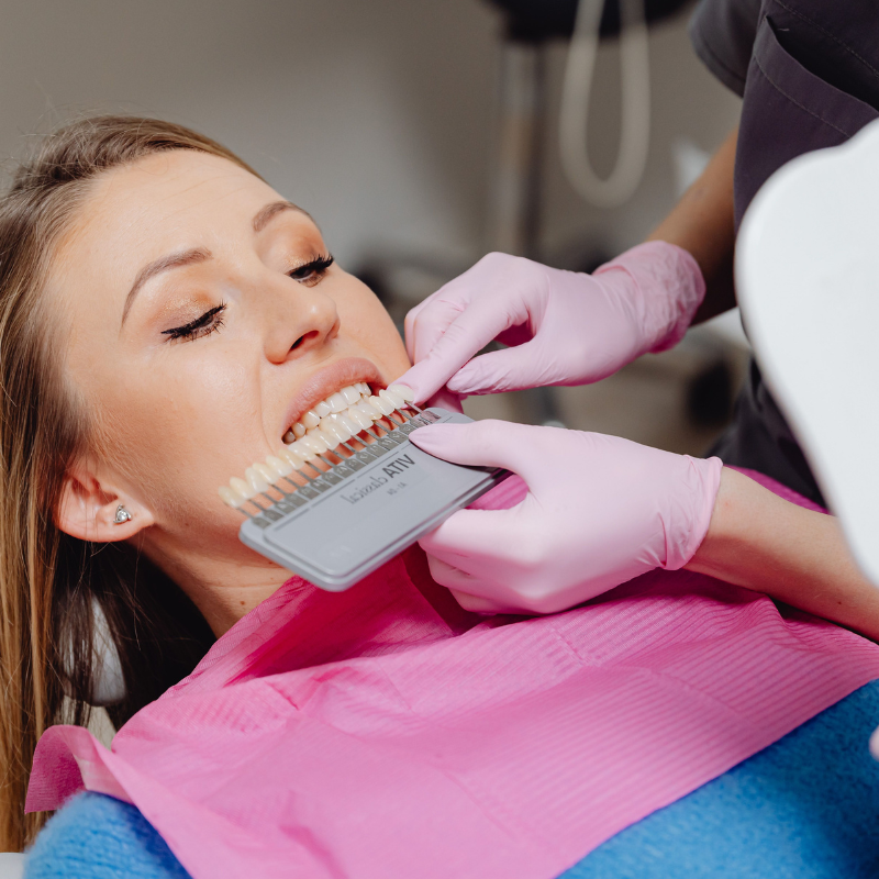 Veneers Mobile